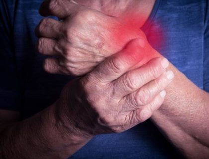 Čuvajte se osteoartritisa